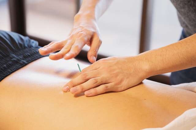 Answers to Your Questions About Acupuncture